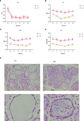 A high-concentrate diet induces inflammatory injury via regulating Ca2+/CaMKKβ-mediated autophagy in mammary gland tissue of dairy cows